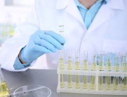 Arti 8 Warna Urine, Sinyal Kondisi Kesehatan