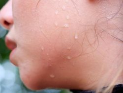 TERNYATA BERKERINGAT BISA SEHATKAN KULIT DAN BUANG RACUN